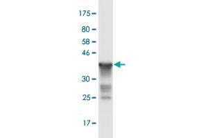 Western Blot detection against Immunogen (36. (RNF20 anticorps  (AA 177-276))