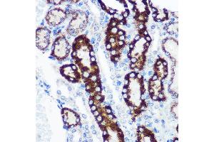 Immunohistochemistry of paraffin-embedded Mouse kidney using FCHSD1 Rabbit pAb (ABIN7270317) at dilution of 1:100 (40x lens).