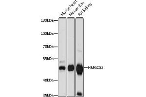 Western blot analysis of extracts of various cell lines, using HMGCS2 antibody (ABIN7265329) at 1:1000 dilution. (HMGCS2 anticorps  (AA 269-508))