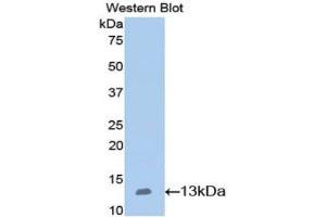 Detection of Recombinant NPHN, Mouse using Polyclonal Antibody to Nephrin (NPHN)