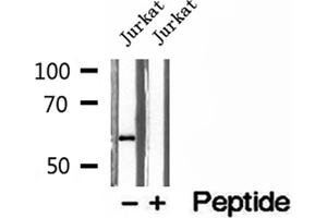 Western blot analysis of extracts of Jurkat cells, using PHGDH antibody. (PHGDH anticorps  (N-Term))