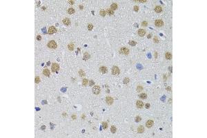 Immunohistochemistry of paraffin-embedded mouse brain using DMAP1 antibody (ABIN4903487) at dilution of 1:100 (40x lens). (DMAP1 anticorps)