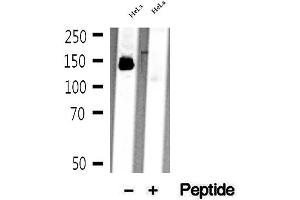 Western blot analysis of extracts of HeLa cells, using mDia1 antibody. (DIAPH1 anticorps)