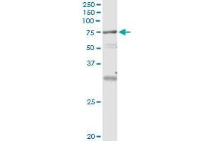 Immunoprecipitation of VPS18 transfected lysate using anti-VPS18 monoclonal antibody and Protein A Magnetic Bead , and immunoblotted with VPS18 MaxPab rabbit polyclonal antibody.