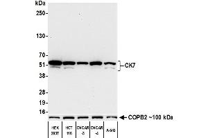 Western Blotting (WB) image for anti-Keratin 7 (KRT7) (C-Term) antibody (ABIN7455167)