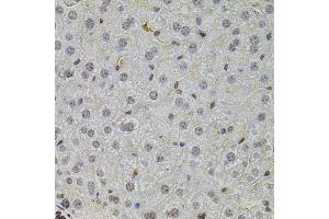 Immunohistochemistry of paraffin-embedded mouse liver using SKP2 antibody (ABIN1874793) at dilution of 1:100 (40x lens). (SKP2 anticorps)