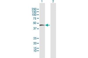 Western Blot analysis of CPA1 expression in transfected 293T cell line by CPA1 MaxPab polyclonal antibody. (CPA1 anticorps  (AA 1-419))