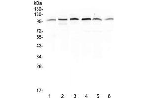 Western blot testing of human 1) placenta, 2) HepG2, 3) A549, 4) PANC-1, 5) SGC-7901 and 6) MDA-MB-231 lysate with MVP antibody at 0. (MVP anticorps)