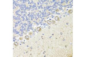Immunohistochemistry of paraffin-embedded rat cerebellum using TrkA Antibody (ABIN3022908, ABIN3022909, ABIN3022910 and ABIN6219291) at dilution of 1:100 (40x lens).