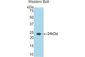 Western blot analysis of the recombinant protein. (Retinol Binding Protein 5 anticorps  (AA 19-201))