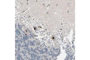 Immunohistochemical staining of human cerebellum with PSMA2 polyclonal antibody  shows strong nuclear positivity in purkinje cells. (PSMA2 anticorps)