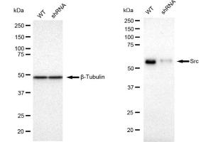 Western blotting analysis using Src antibody (ABIN7800055). (Recombinant Src anticorps)