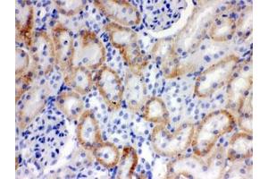 IHC testing of FFPE rat kidney with SLC22A2 antibody. (SLC22A2 anticorps)