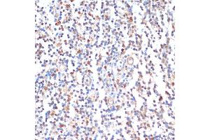 anti-Zinc Finger Protein 261 (ZMYM3) (AA 140-300) antibody