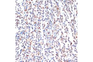 Immunohistochemistry of paraffin-embedded human tonsil using ZMYM3 antibody (ABIN6128940, ABIN6150453, ABIN6150454 and ABIN6216809) at dilution of 1:100 (40x lens). (ZMYM3 anticorps  (AA 140-300))