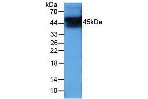 Detection of PIM1 in Human PC-3 cells using Polyclonal Antibody to Pim-1 Oncogene (PIM1)