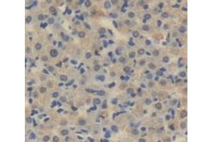 IHC-P analysis of Human Tissue, with DAB staining. (LOXL3 anticorps  (AA 519-726))