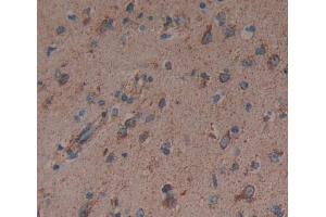 Used in DAB staining on fromalin fixed paraffin- embedded brain tissue