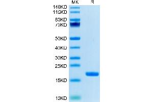 SDS-PAGE (SDS) image for Interleukin 18 (IL18) (AA 37-193) protein (Biotin) (ABIN7274881)