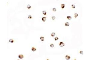 Immunocytochemistry of TGM7 in A549 cells with TGM7 antibody at 2. (Transglutaminase 7 anticorps  (Middle Region))