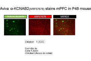 Sample Type: P48 MouseDilution: 1:2000 (KCNAB2 anticorps  (Middle Region))