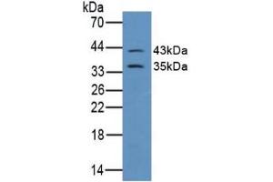 Figure. (Connexin 43/GJA1 anticorps  (AA 244-382))