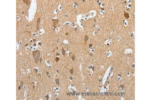 Immunohistochemistry of Human brain  using RCAN1 Polyclonal Antibody at dilution of 1:45 (RCAN1 anticorps)
