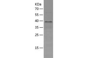 Western Blotting (WB) image for Tumor Suppressing Subtransferable Candidate 4 (TSSC4) (AA 1-265) protein (His tag) (ABIN7125565)