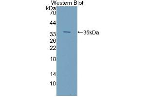 Western blot analysis of the recombinant protein. (ILK anticorps  (AA 183-452))