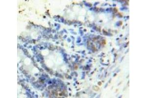 Used in DAB staining on fromalin fixed paraffin-embedded Bowels tissue (HMGA1 anticorps  (AA 1-107))