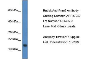 Western Blotting (WB) image for anti-Proline Rich Nuclear Receptor Coactivator 2 (PNRC2) (N-Term) antibody (ABIN2787027)