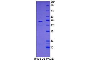 SDS-PAGE analysis of Mouse FOLR4 Protein. (Folate Receptor 4 Protéine)