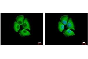 ICC/IF Image 14-3-3 sigma antibody detects 14-3-3 sigma protein at cytoplasm by immunofluorescent analysis.