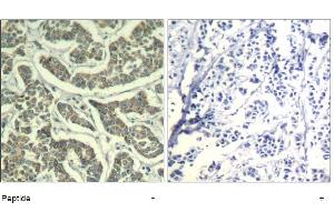 Image no. 1 for anti-Ataxia Telangiectasia and Rad3 Related (ATR) (Ser428) antibody (ABIN319380) (ATR anticorps  (Ser428))