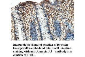 Image no. 1 for anti-Annexin A5 (ANXA5) antibody (ABIN791195) (Annexin V anticorps)