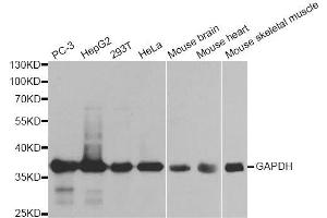 Western blot analysis of extracts of various cell lines, using GAPDH antibody. (GAPDH anticorps  (AA 1-335))