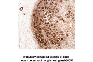 Image no. 1 for anti-Neurofibromin 1 (NF1) (N-Term) antibody (ABIN363207)