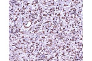 IHC analysis of MEK7/MAP2K7 using anti-MEK7/MAP2K7 antibody (ABIN3043875). (MAP2K7 anticorps  (N-Term))