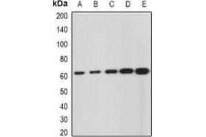 Western blot analysis of GNS expression in SKOV3 (A), Hela (B), mouse liver (C), mouse kidney (D), rat brain (E) whole cell lysates. (GNS anticorps)
