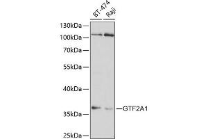 Western blot analysis of extracts of various cell lines, using GTF2 antibody (ABIN6128820, ABIN6141488, ABIN6141489 and ABIN6220980) at 1:1000 dilution. (GTF2A1 anticorps  (AA 1-270))