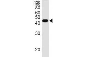 Western blot analysis of lysate from RPMI8226 cell line using CD38 antibody diluted at 1:1000.