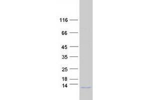 Validation with Western Blot