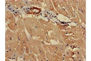 Immunohistochemistry of paraffin-embedded human heart tissue using ABIN7164812 at dilution of 1:100 (PCCA anticorps  (AA 585-720))