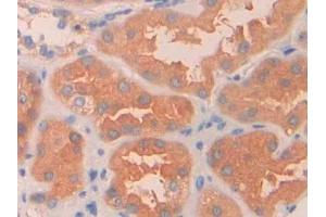Detection of PAH in Human Kidney Tissue using Polyclonal Antibody to Phenylalanine Hydroxylase (PAH)