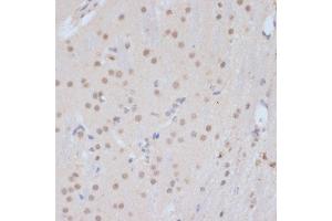 Immunohistochemistry of paraffin-embedded mouse brain using CDK9 antibody (ABIN6129241, ABIN6138331, ABIN6138332 and ABIN6214015) at dilution of 1:100 (40x lens).