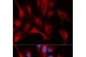 Immunofluorescence analysis of U2OS cells using PSMB4 Polyclonal Antibody (PSMB4 anticorps)