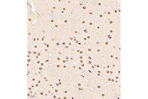 Immunohistochemistry of paraffin embedded mouse brain using RBAK (ABIN7075383) at dilution of 1:1000 (400x lens) (RBAK anticorps)