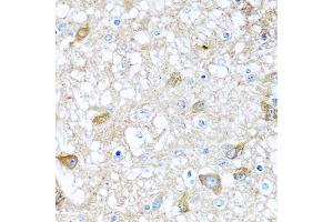 Immunohistochemistry of paraffin-embedded rat brain using BMP5 antibody (ABIN5974675) at dilution of 1/100 (40x lens).