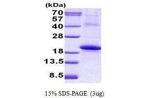 Figure annotation denotes ug of protein loaded and % gel used. (IL18BP Protéine)