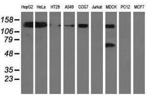 Image no. 2 for anti-L1 Cell Adhesion Molecule (L1CAM) antibody (ABIN1499086) (L1CAM anticorps)